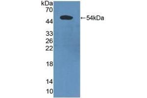 Detection of Recombinant PDCD6IP, Human using Polyclonal Antibody to Programmed Cell Death Protein 6 Interacting Protein (PDCD6IP) (ALIX antibody  (AA 174-383))
