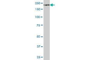 ITGA1 MaxPab polyclonal antibody. (Integrin alpha 1 antibody  (AA 1-1179))