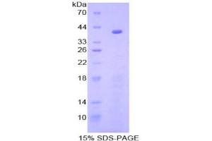 SDS-PAGE (SDS) image for Nuclear Factor kappa B (NFkB) (AA 40-365) protein (His tag) (ABIN1080394)