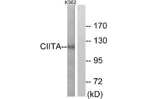 Western Blotting (WB) image for anti-Class II, Major Histocompatibility Complex, Transactivator (CIITA) (Internal Region) antibody (ABIN1849325) (CIITA antibody  (Internal Region))