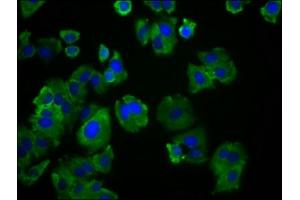 Immunofluorescence staining of HepG2 cells with ABIN7171984 at 1:166, counter-stained with DAPI. (SLC19A3 antibody  (AA 191-282))