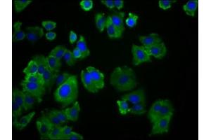 Immunofluorescence staining of HepG2 cells with ABIN7171984 at 1:166, counter-stained with DAPI.