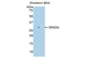 Detection of Recombinant ITLN1, Mouse using Polyclonal Antibody to Intelectin 1 (ITLN1) (ITLN1/Omentin antibody  (AA 28-270))