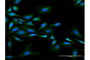 Immunofluorescence of purified MaxPab antibody to NMI on HeLa cell. (NMI antibody  (AA 1-307))