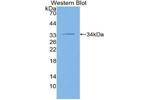 Western blot analysis of the recombinant protein. (ADCY1 antibody  (AA 303-569))