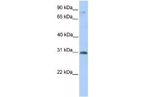 Human Placenta; WB Suggested Anti-ABHD13 Antibody Titration: 0. (ABHD13 antibody  (C-Term))