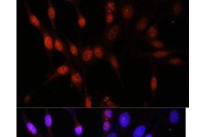 Immunofluorescence analysis of NIH/3T3 cells using KAT6A Polyclonal Antibody at dilution of 1:100. (MYST3 antibody)