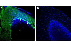 Expression of CD38 in mouse cerebellum. (CD38 antibody  (Extracellular))