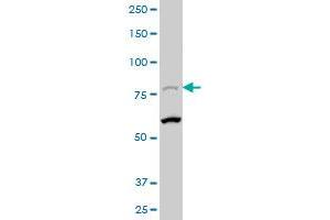 AOC2 polyclonal antibody (A01), Lot # 051206JC01 Western Blot analysis of AOC2 expression in IMR-32 . (AOC2 antibody  (AA 169-268))