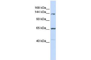 WB Suggested Anti-PCDH12 Antibody Titration:  0.