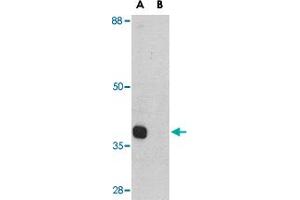 Western blot analysis of ATG12 in mouse heart tissue lysate with ATG12 polyclonal antibody  at 1 ug/mL in (A) the absence and (B) the presence of blocking peptide. (ATG12 antibody  (Internal Region))