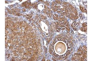 IHC-P Image Septin 2 antibody [N1N3] detects Septin 2 protein at cytosol on mouse ovary by immunohistochemical analysis.