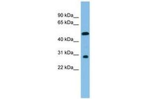 Image no. 1 for anti-Homeobox C8 (HOXC8) (C-Term) antibody (ABIN6744687)