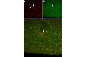 Expression of SSTR3 in mouse cerebellumImmunohistochemical staining of mouse cerebellum with Anti-Somatostatin Receptor Type 3 Antibody (ABIN7237867, ABIN7316732 and ABIN7316733).