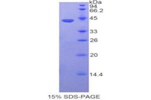 SDS-PAGE (SDS) image for Fibulin 4 (FBLN4) (AA 17-169) protein (His tag,GST tag) (ABIN1877876)