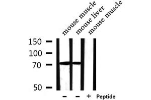 Western blot analysis of extracts from mouse muscle,mouse liver, using PABPC4 Antibody. (PABPC4 antibody  (Internal Region))
