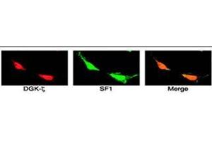 SF1 colocalizes with DGK and  in the nuclei of H295R cells.