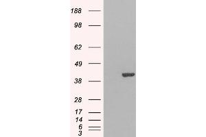 Western Blotting (WB) image for anti-GRB2-Related Adaptor Protein 2 (GRAP2) antibody (ABIN5901198) (GRAP2 antibody)