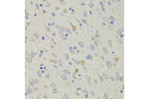 Immunohistochemistry of paraffin-embedded mouse brain using RAE1 antibody (ABIN5974056) at dilution of 1/100 (40x lens). (RAE1 antibody)