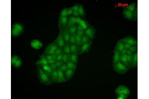 Immunocytochemistry/Immunofluorescence analysis using Rabbit Anti-Calnexin-CT Polyclonal Antibody . (Calnexin antibody  (C-Term) (PE))