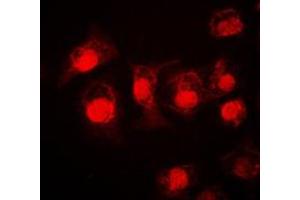 Immunofluorescent analysis of STAT3 staining in A549 cells. (STAT3 antibody  (C-Term))
