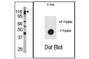 Image no. 1 for anti-Colony Stimulating Factor 2 Receptor, Beta (CSF2RB) (pTyr766) antibody (ABIN358147) (CD131 antibody  (pTyr766))
