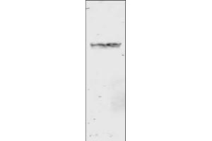 Image no. 2 for anti-Glutathione S Transferase (GST) antibody (ABIN226631) (GST antibody)
