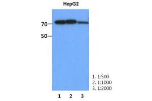 Image no. 1 for anti-phosphofructokinase, Muscle (PFKM) (AA 1-780), (N-Term) antibody (ABIN1449415)