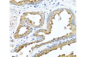 Immunohistochemistry of paraffin-embedded Human prostate using NCK2 Polyclonal Antibody at dilution of 1:100 (40x lens). (NCK2 antibody)