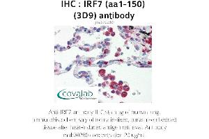 Image no. 2 for anti-Interferon Regulatory Factor 7 (IRF7) (AA 1-150) antibody (ABIN1723206) (IRF7 antibody  (AA 1-150))