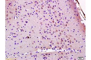 Immunohistochemistry (IHC) image for anti-Junction Mediating and Regulatory Protein, P53 Cofactor (JMY) (AA 401-500) antibody (ABIN872348)