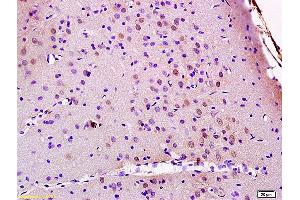 Formalin-fixed and paraffin embedded rat brain labeled with Anti JMY Polyclonal Antibody, Unconjugated (ABIN872348) at 1:200 followed by conjugation to the secondary antibody and DAB staining (JMY antibody  (AA 401-500))