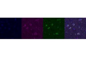 Immunohistochemistry (IHC) image for anti-Kv Channel Interacting Protein 2 (KCNIP2) antibody (ABIN7456001) (KCNIP2 antibody)