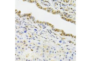 Immunohistochemistry of paraffin-embedded rat liver using EFTUD2 Antibody (ABIN5974236) at dilution of 1/100 (40x lens). (EFTUD2 antibody)