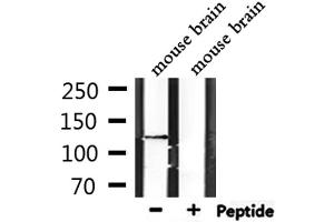 Western blot analysis of extracts from mouse brain, using CTNND2 Antibody. (CTNND2 antibody  (C-Term))