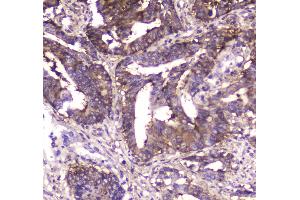 IHC analysis of MVP using anti-MVP antibody . (MVP antibody  (AA 2-259))