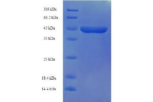 SDS-PAGE (SDS) image for Ethylmalonic Encephalopathy 1 (ETHE1) (AA 8-254) protein (His-SUMO Tag) (ABIN4976192)