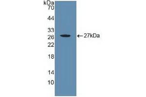 Detection of Recombinant CYR61, Human using Polyclonal Antibody to Cysteine Rich Protein, Angiogenic Inducer 61 (CYR61) (CYR61 antibody  (AA 178-381))