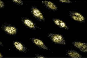 Immunofluorescence staining of Human Endothelial cells. (POLD1 antibody  (AA 60-261))