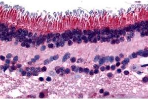 Human Retina (formalin-fixed, paraffin-embedded) stained with PTPRM antibody ABIN297531 at 16 ug/ml followed by biotinylated goat anti-rabbit IgG secondary antibody ABIN481713, alkaline phosphatase-streptavidin and chromogen. (PTPRM antibody  (Internal Region))