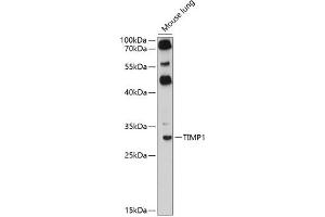 Immunofluorescence analysis of HeLa cells using TIMP1 antibody (ABIN6128284, ABIN6149176, ABIN6149177 and ABIN6218052) at dilution of 1:100. (TIMP1 antibody  (AA 24-207))