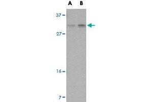 Western blot analysis of PIGY in human spleen tissue lysate with PIGY polyclonal antibody  at (A) 1 and (B) 2 ug/mL .