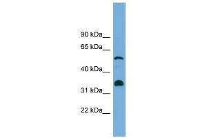 CYP26B1 antibody used at 1 ug/ml to detect target protein. (CYP26B1 antibody  (Middle Region))