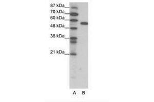 Image no. 1 for anti-Forkhead Box C2 (MFH-1, Mesenchyme Forkhead 1) (FOXC2) (AA 412-461) antibody (ABIN202668) (FOXC2 antibody  (AA 412-461))