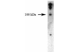 Western blot analysis of Dynamin II on a HeLa cell lysate (Human cervical epitheloid carcinoma, ATCC CCL-2) using 1 µg/mL of the Mouse Anti-Dynamin II antibody.
