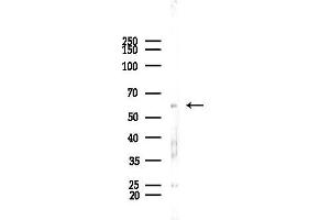 anti-Zinc Finger Protein 248 (ZNF248) antibody