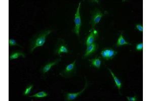 Immunofluorescence staining of U251 cells with ABIN7159457 at 1:66, counter-stained with DAPI. (Cyclin M3 antibody  (AA 358-645))