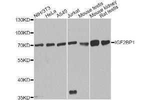 Western blot analysis of extracts of various cell lines, using IGF2BP1 antibody. (IGF2BP1 antibody  (C-Term))