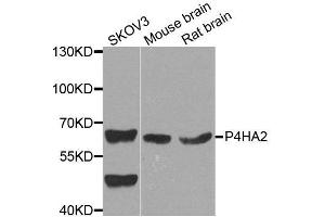 Western blot analysis of extracts of various cell lines, using P4HA2 antibody. (P4HA2 antibody  (AA 234-533))