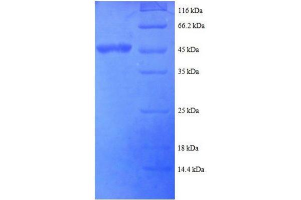 ADAR Protein (AA 1-176) (His-SUMO Tag)